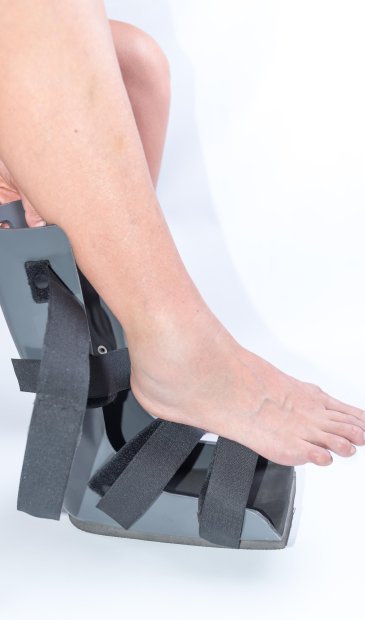 Halluks Valgus - Ayak Başparmak Ateli